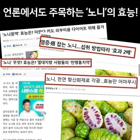 앙쥬 프로페셔널 노니 두피 테라피 샴푸 750ml 모근강화 건강한 모발