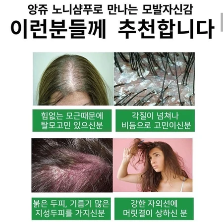 앙쥬 프로페셔널 노니 두피 테라피 샴푸 750ml 모근강화 건강한 모발